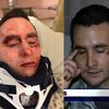 Man Punched On The Bowery Convinced He's Victim Of "Knockout" Game